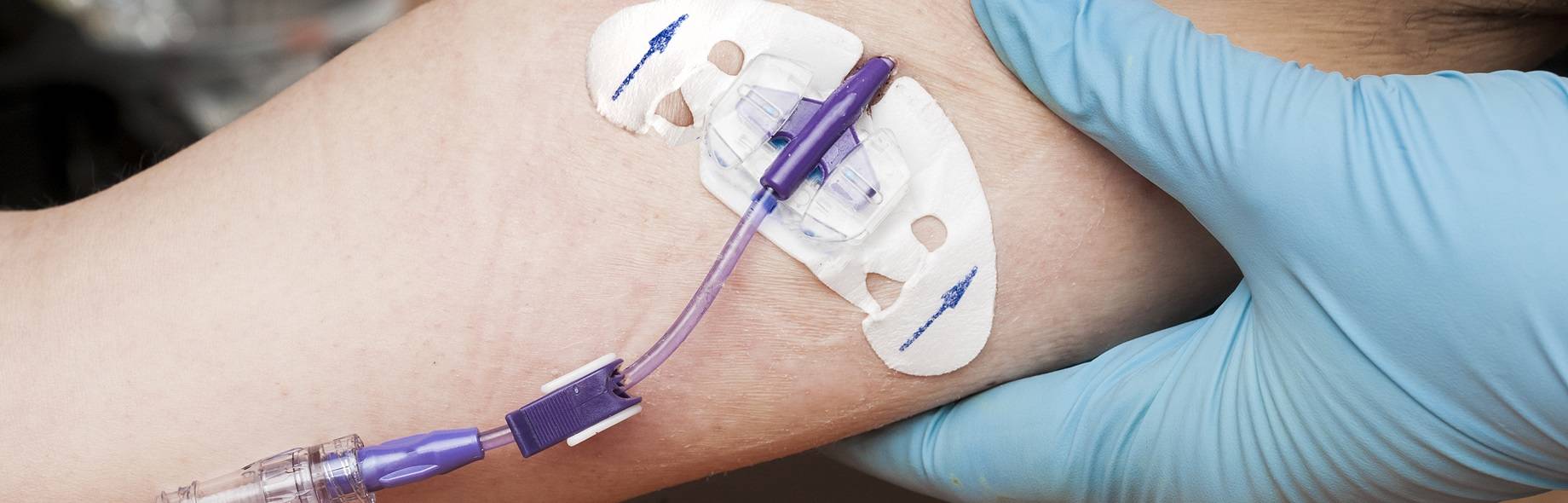 ambulante-parenterale-antiinfektiva-therapie