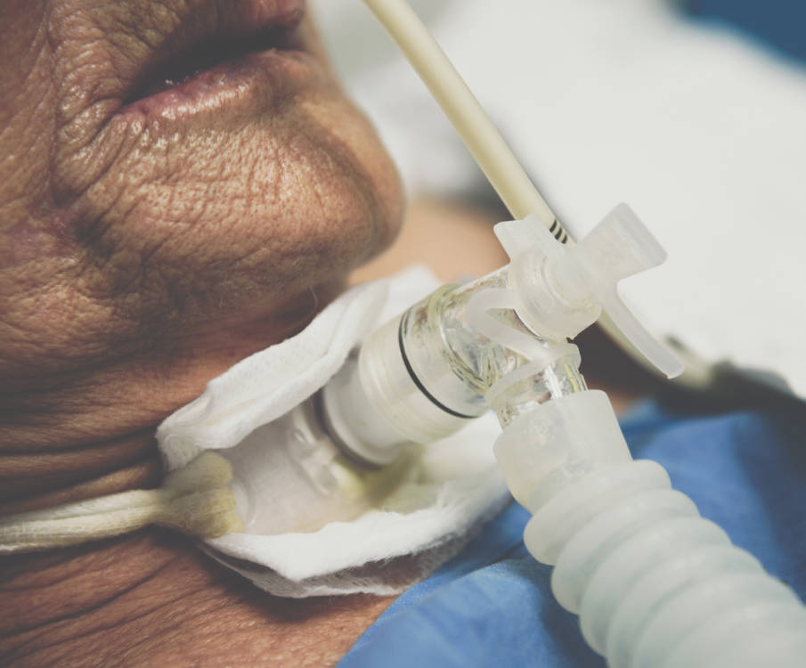 alte Frau mit Tracheostoma